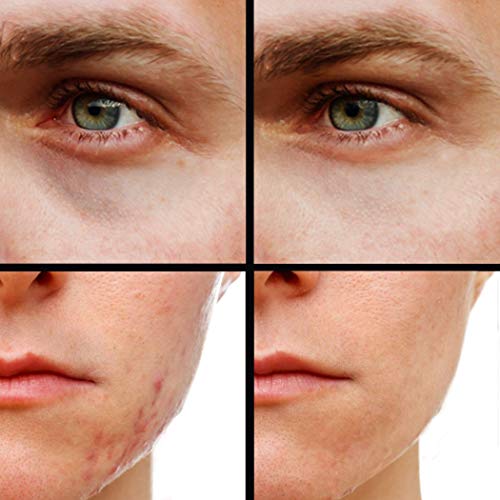 Under Eye Concealer Cream, Dark Circle Corrector Y196784